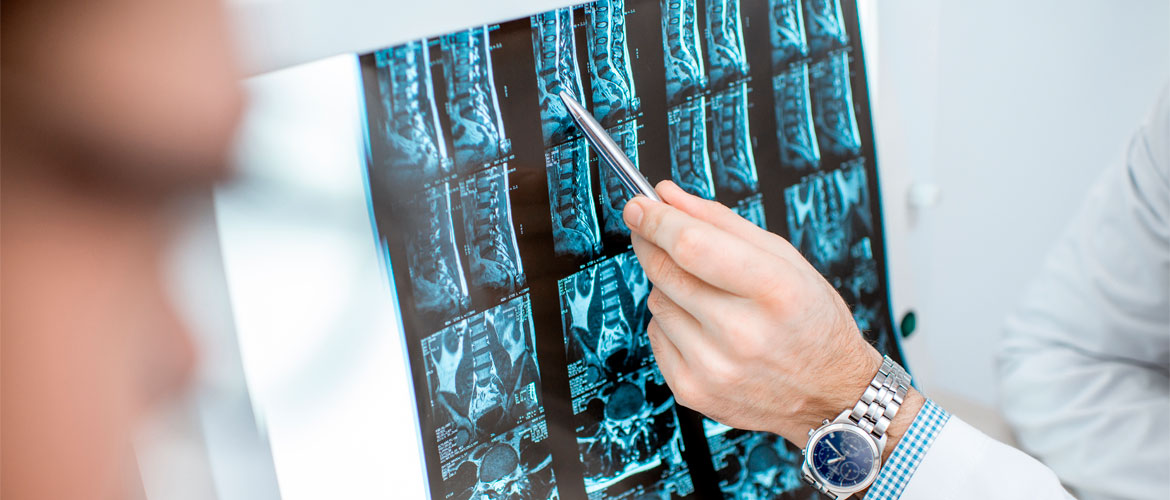 Ejercicios recomendados y contraindicados en casos de hernia discal lumbar