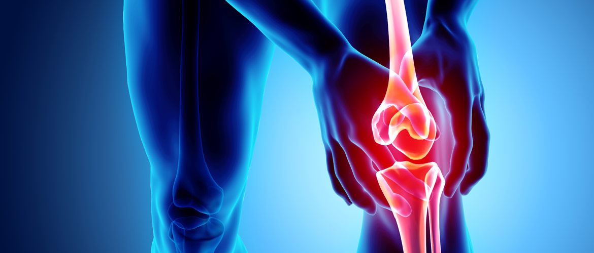 Condropatía rotuliana ¿cómo tengo que entrenar?